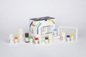 IgE / pishtaz teb / پیشتاز طب / کیت تشخیص طبی 
